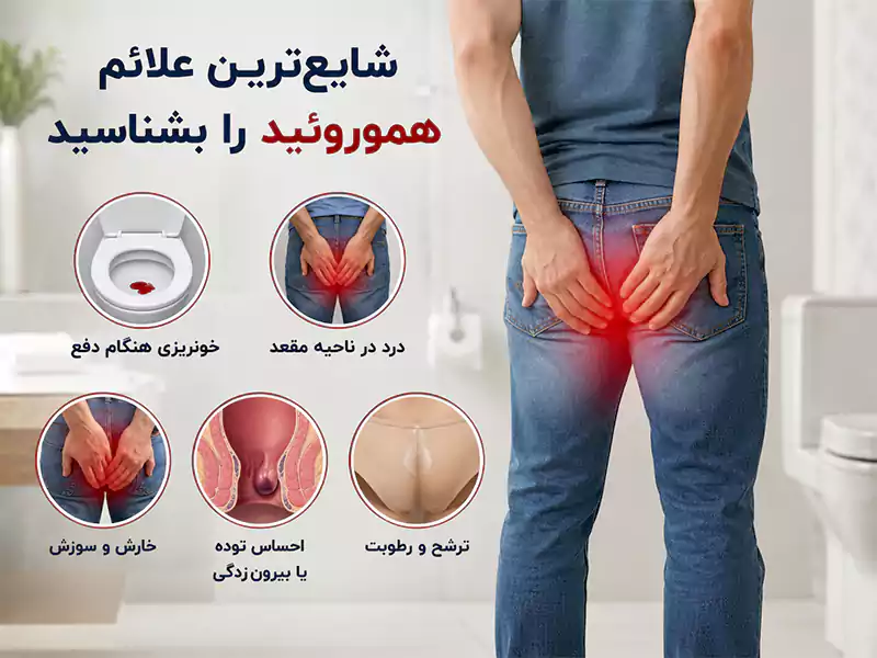 شایع‌ترین علائم هموروئید را بشناسید